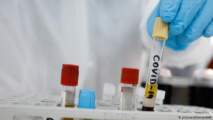 Самый первый симптом коронавируса: испанские ученые сделали важное открытие