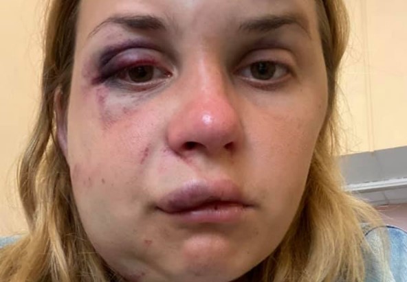 В поезде "Укрзализныци" женщину избили и хотели изнасиловать на глазах у сына