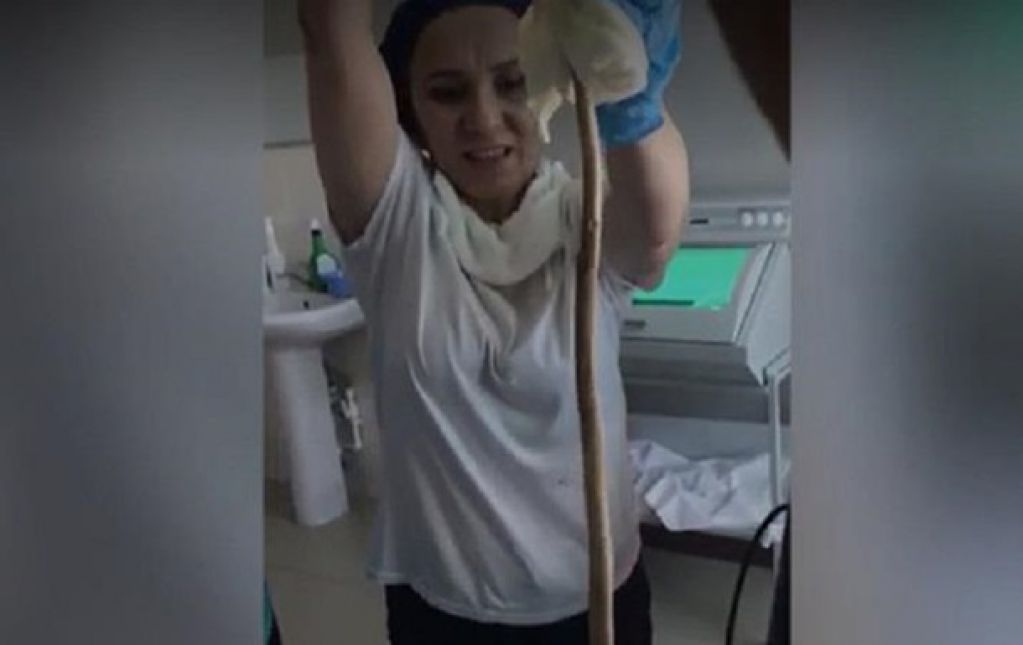 Атаковала во сне: змея заползла в желудок женщине