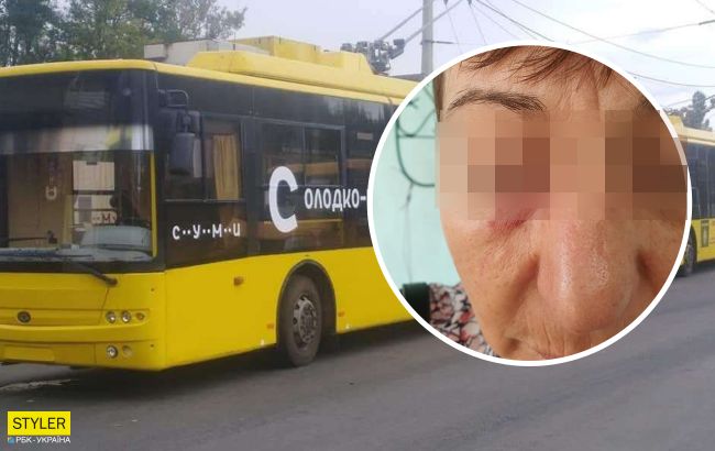 В Сумах пассажир из-за маски изувечила кондуктора: подробности происшествия