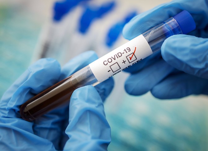 Бесплатные тесты и лекарство от COVID: в Кабмине приняли важное постановление