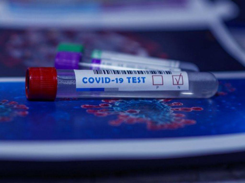 Пандемія: число інфікованих COVID-19 становить понад 41,5 млн