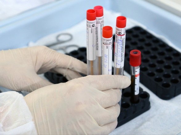 Минздрав ждет завершения испытаний "антигенных" тестов на "ковид"