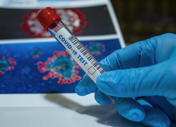 Херсонщина отметилась антирекордом: за сутки заболели коронавирусом 162 человека