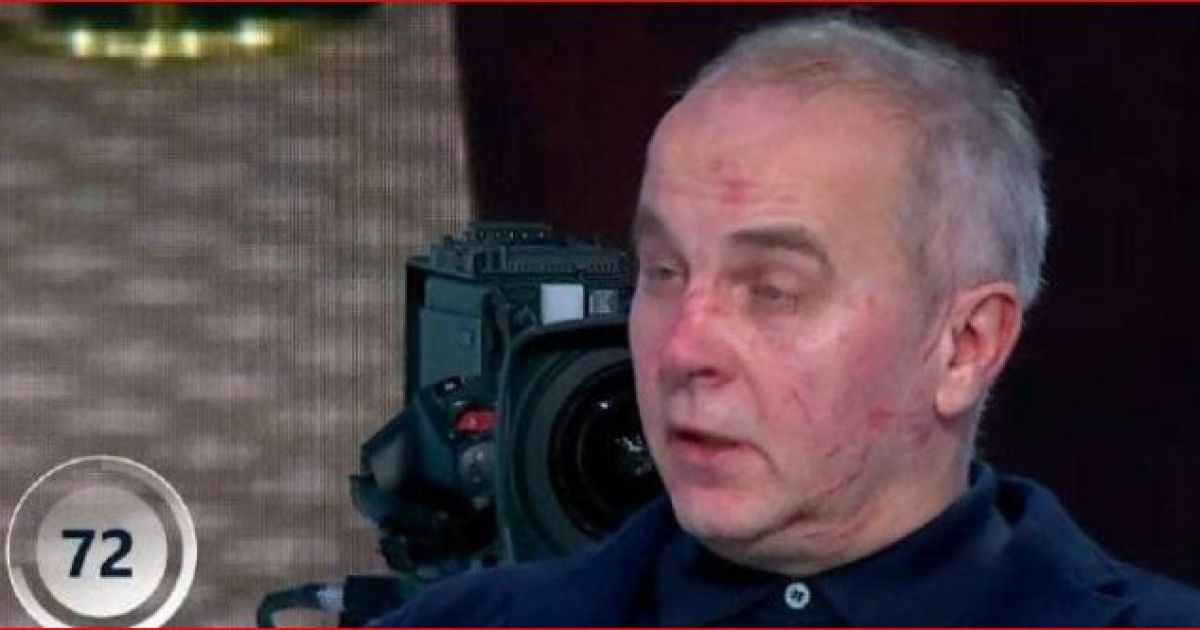 Шуфрича избили