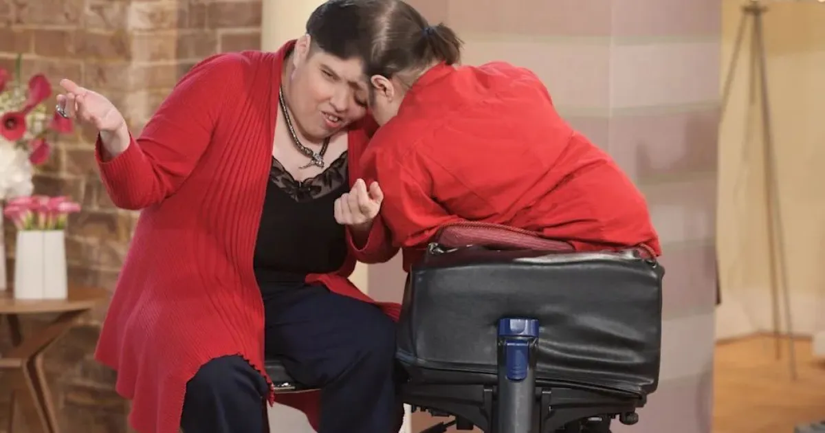 Сіамські близнюкі