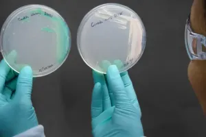 Грибок Candida auris