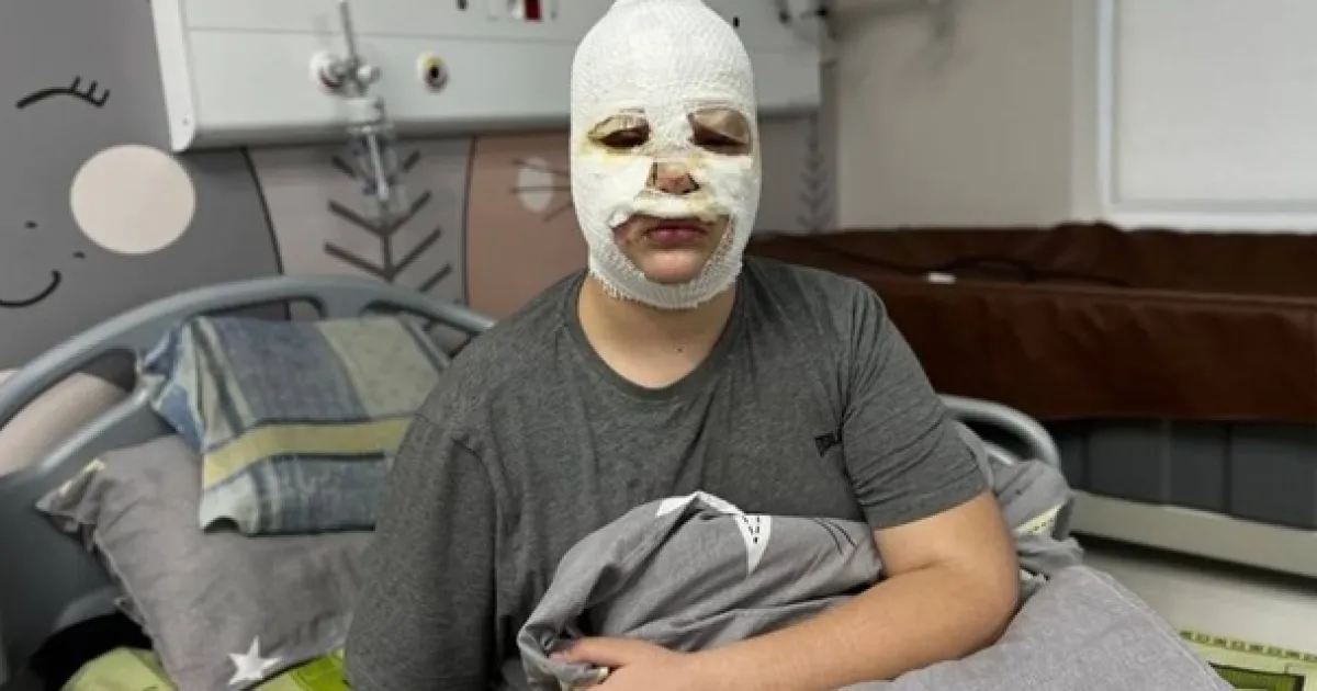 пострадавший от петарды