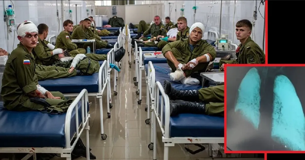 операция труба