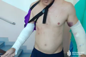 travma