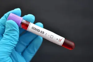 COVID-19