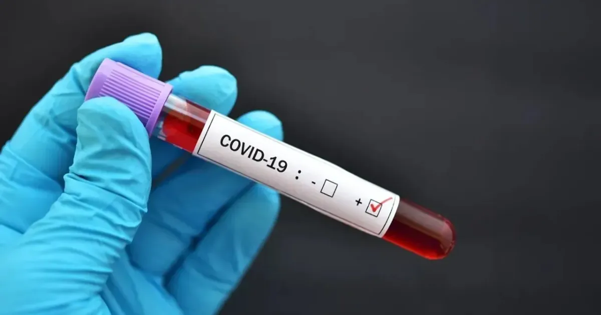 COVID-19